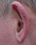 Mystery Ear